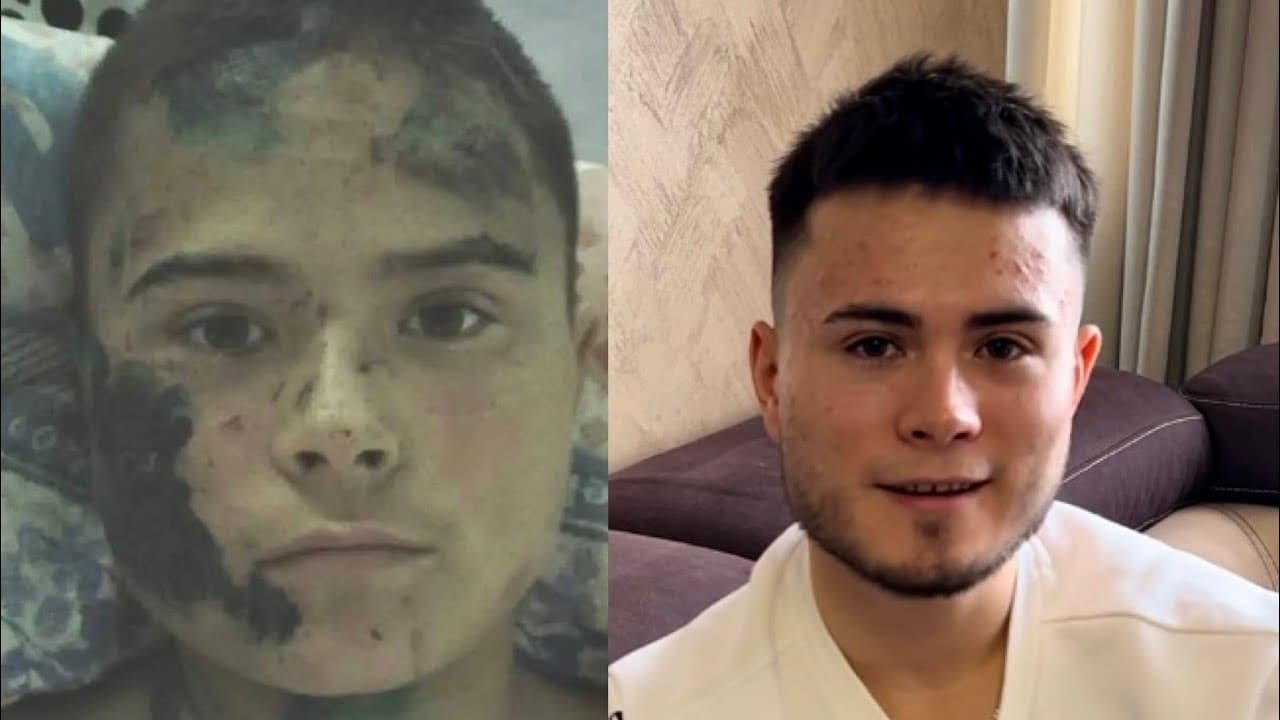 Rîșcani: A fost lovit cu mașina de polițistul din sat, care a vrut să fugă de la fața locului [VIDEO]