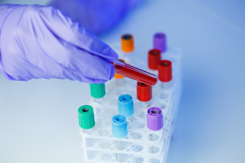 Eprubete cu probe biologice într-un laborator de analize medicale