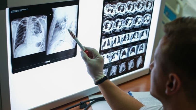 Telenești: radiografie pulmonară gratuită în cinci sate, între 12 și 16 octombrie